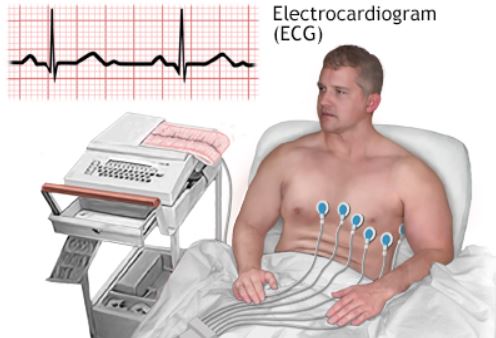 What Is Use of ECG Test Report